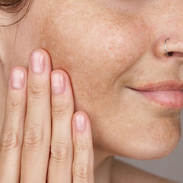 Peeling enzymatyczny: Kompletny przewodnik po złuszczaniu i odnowie skóry